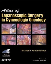Atlas of Laparoscopic Surgery in Gynecologic Oncology with 2 DVD-ROMs