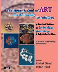 The Heart and Soul of ART