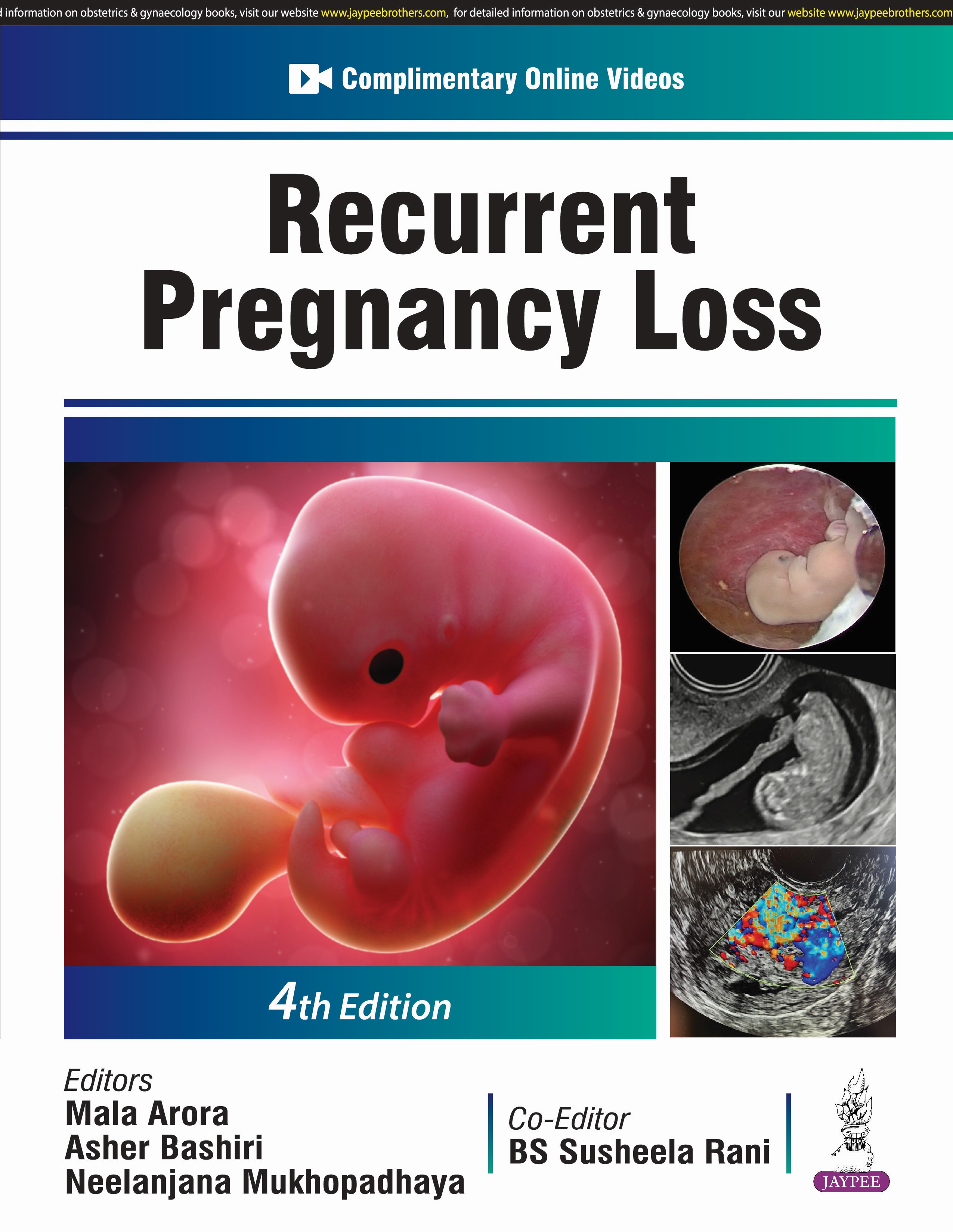 Recurrent Pregnancy Loss (Available at Pre-Order! Free Shipping! Book is expected be released by 28th Feb 2025)