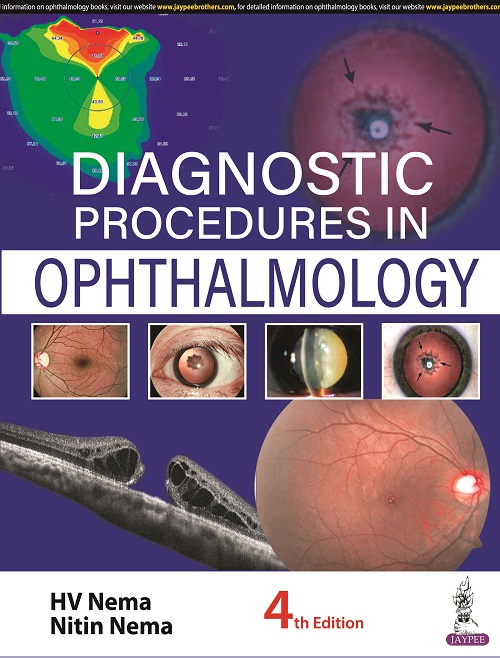 Diagnostic Procedures in Ophthalmology