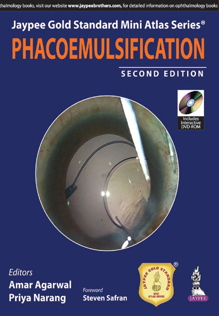 Jaypee Gold Standard Mini Atlas Series: Phacoemulsification (with DVD)