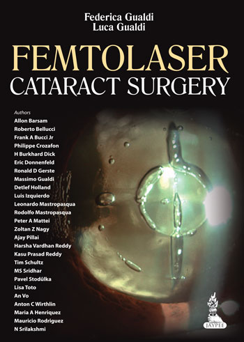 Femtolaser Cataract Surgery