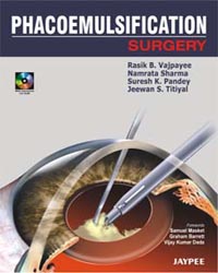 Phacoemulsification Surgery: A Practical Manual (with CD-ROM)