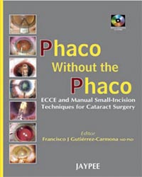 Phaco without Phaco with 2 CD-ROMs