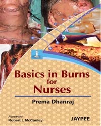 Basics in Burns for Nurses