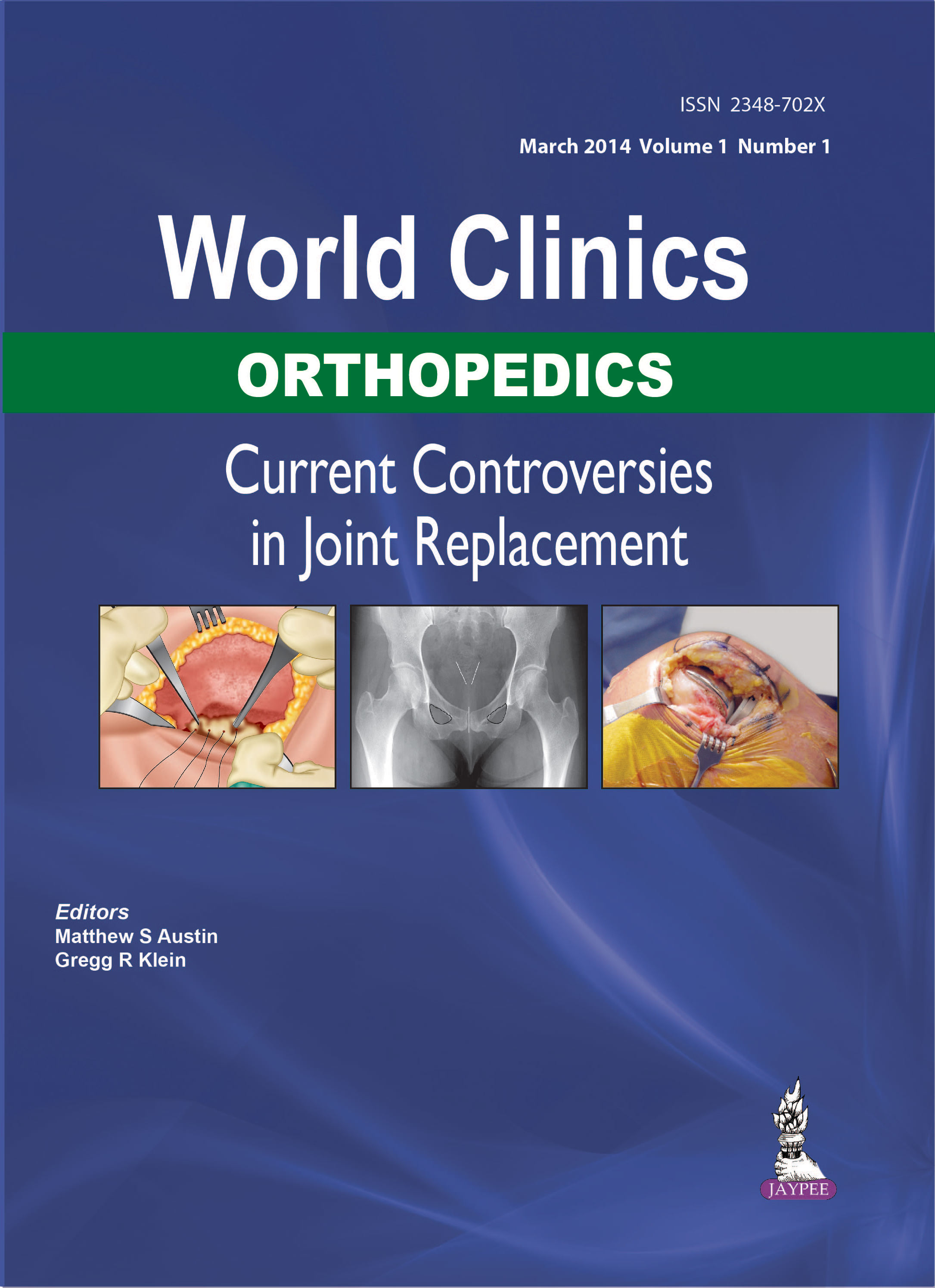 World Clinics Orthopedics: Current Controversies in Joint Replacement