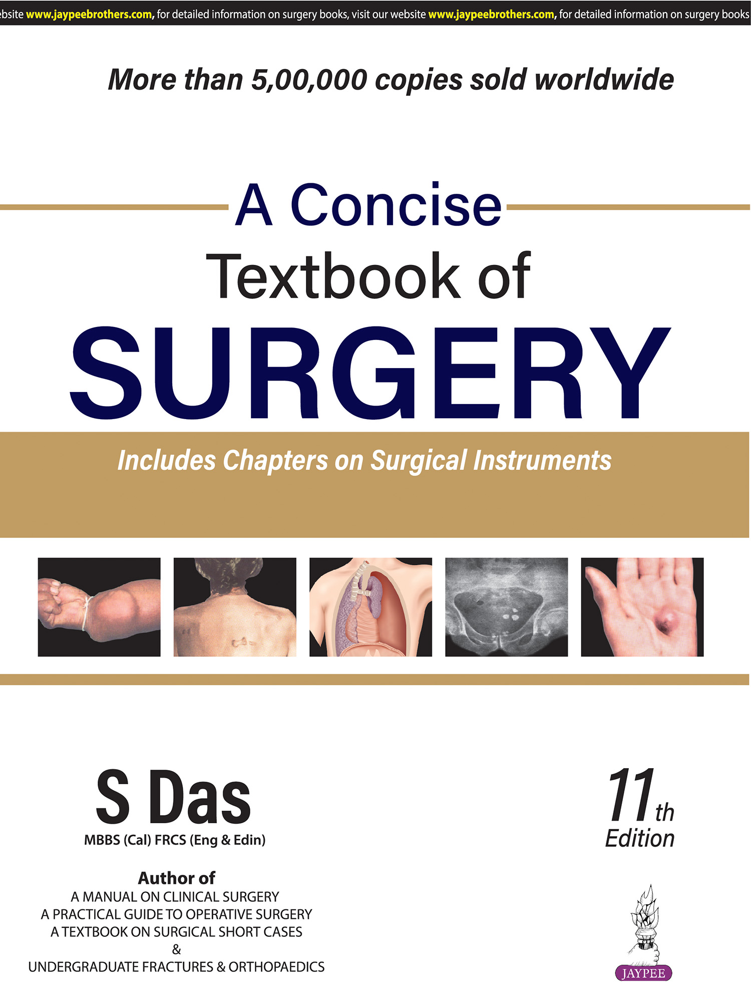 A Concise Textbook of Surgery