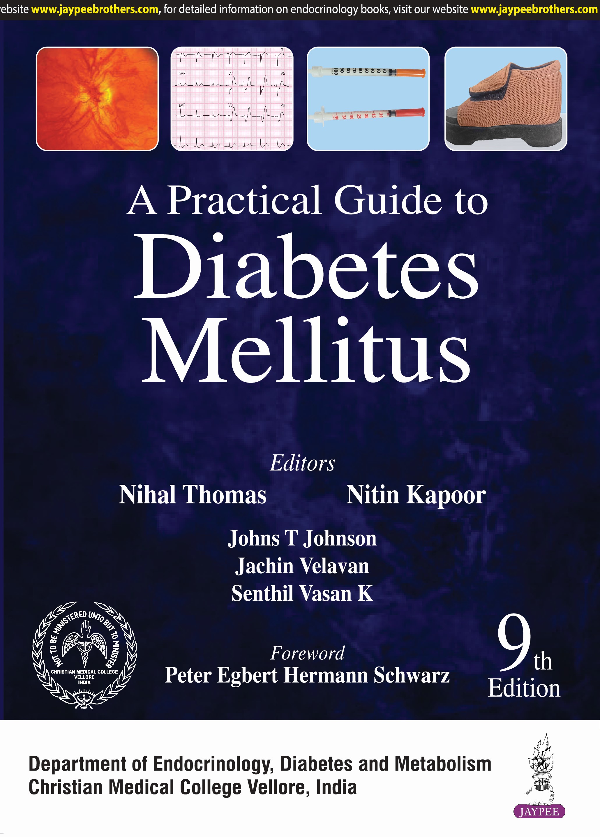 A Practical Guide to Diabetes Mellitus