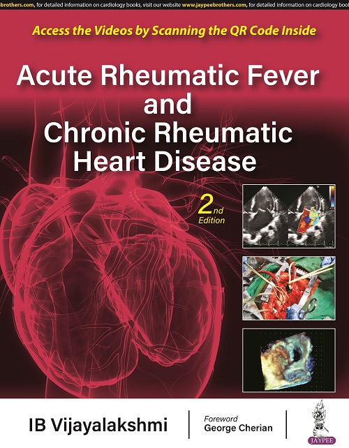 Acute Rheumatic Fever and Chronic Rheumatic Heart Disease