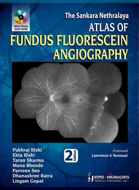 The Sankara Nethralaya: Atlas of Fundus Fluorescein Angiography