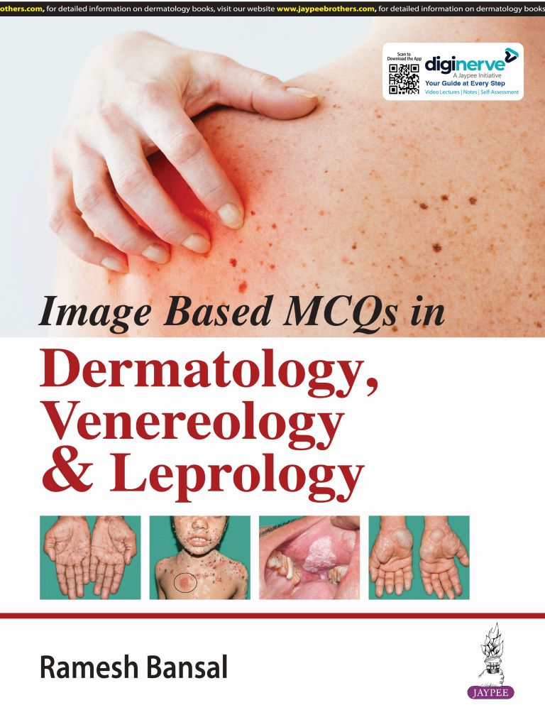 Image Based Mcqs in Dermatology, Venereology & Leprology