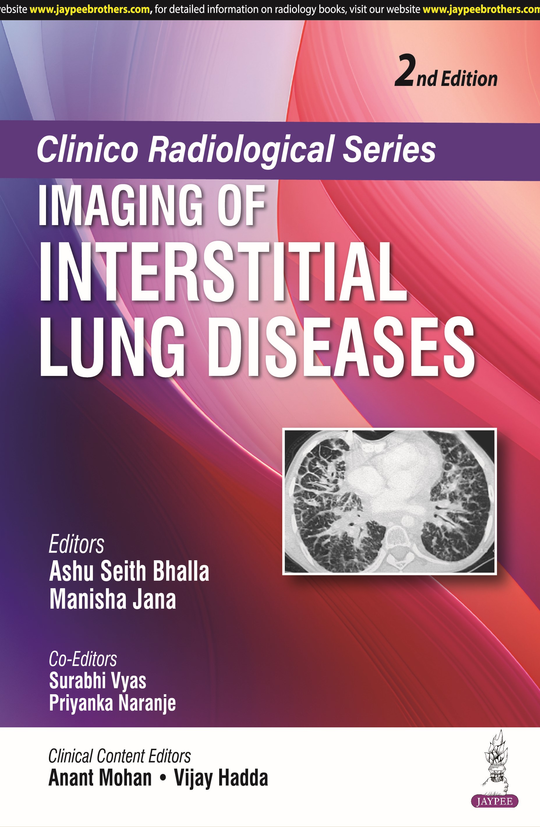 Clinico Radiological Series: Imaging of Interstitial Lung Diseases