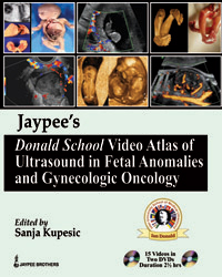 Jaypee’s Donald School Video Atlas of Ultrasound in Fetal Anomalies and Gynecologic Oncology