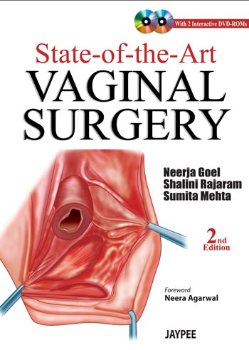 State of the Art Vaginal Surgery (With DVD Rom)