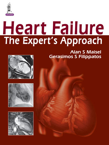 Heart Failure: The Expert’s Approach