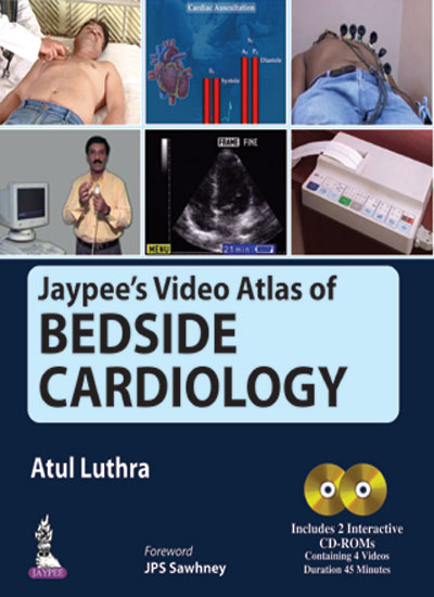 Jaypee’s Video Atlas of Bedside Cardiology