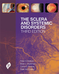 The Sclera and Systemic Disorders