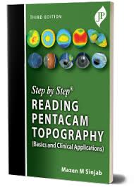 Step by Step Reading Pentacam Topography(Basics and Clinical Applications)