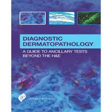 Diagnostic Dermatopathology:A Guide To Ancillary Tests Beyond The H&E