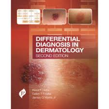 Differential Diagnosis in Dermatology
