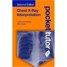 Pocket Tutor Chest X-Ray Interpretation