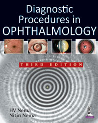 Diagnostic Procedures in Ophthalmology