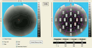 Dr Agarwal'S Textbook On Corneal Topography(Including Pentacam And Anterior Segment Oct)