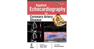 Applied Echocardiography In Coronary Artery Disease Includes Cd-Rom
