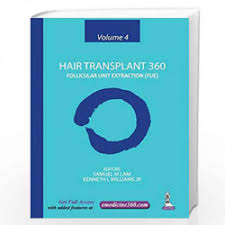 Hair Transplant 360: Follicular Unit Extraction (FUE)