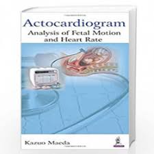 Actocardiogram:Analysis Of Fetal Motion And Heart Rate