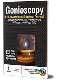 Gonioscopy:A Video Assisted Skill Transfer Approach With Dvd-Rom