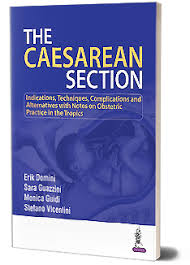 The Caesarean Seciton