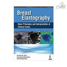 Breast Elastography Basic Principles And Interpretation Of Clinical Cases