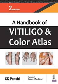 A Handbook Of Vitiligo & Color Atlas