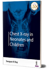 Chest X-ray in Neonates and Children