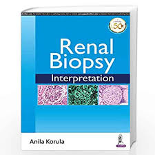 RENAL BIOPSY Interpretation
