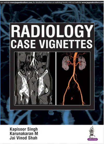 Radiology Case Vignettes