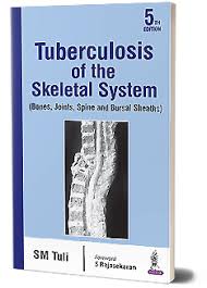 Tuberculosis Of The Skeletal System (Bones,Joints,Spine,And Bursal Sheaths)
