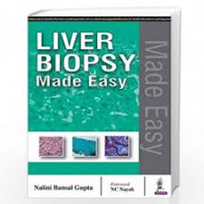Liver Biopsy Made Easy