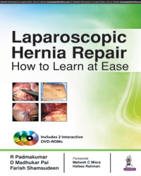 Laparoscopic Hernia Repair:How To Learn At Ease With Dvd-Roms