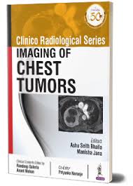 Clinico Radiological Series Imaging of Chest Tumors