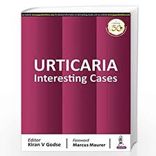 URTICARIA Interesting Cases