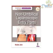 Non-Umbilical Laparoscopic Entry Ports