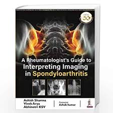 A Rheumatologist’s Guide to Interpreting Imaging in Spondyloarthritis