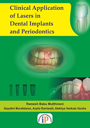 Clinical Application of Lasers in Dental Implants and Periodontics